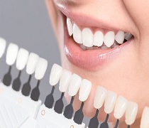 شرایط تاسیس لابراتوار دندانسازی